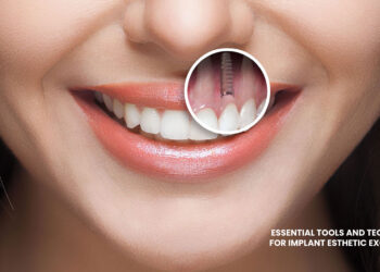 Implant Esthetic Excellence